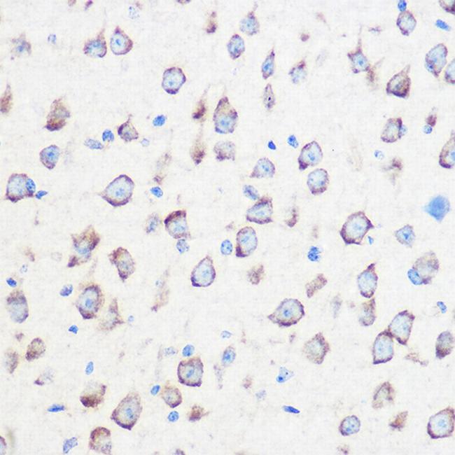 Calmodulin 3 Antibody in Immunohistochemistry (Paraffin) (IHC (P))