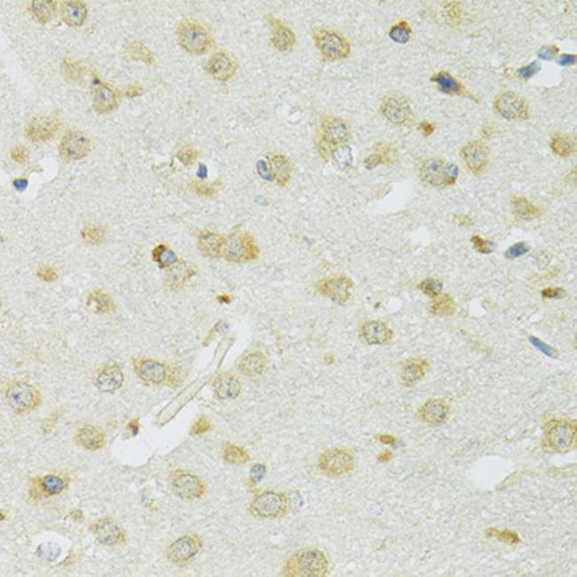 SLC37A4 Antibody in Immunohistochemistry (Paraffin) (IHC (P))