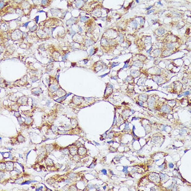 SLC7A2 Antibody in Immunohistochemistry (Paraffin) (IHC (P))