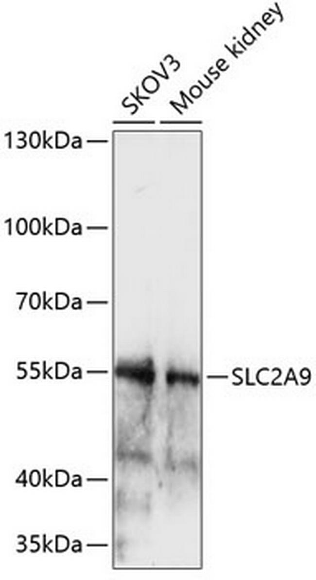 GLUT9 Antibody in Western Blot (WB)