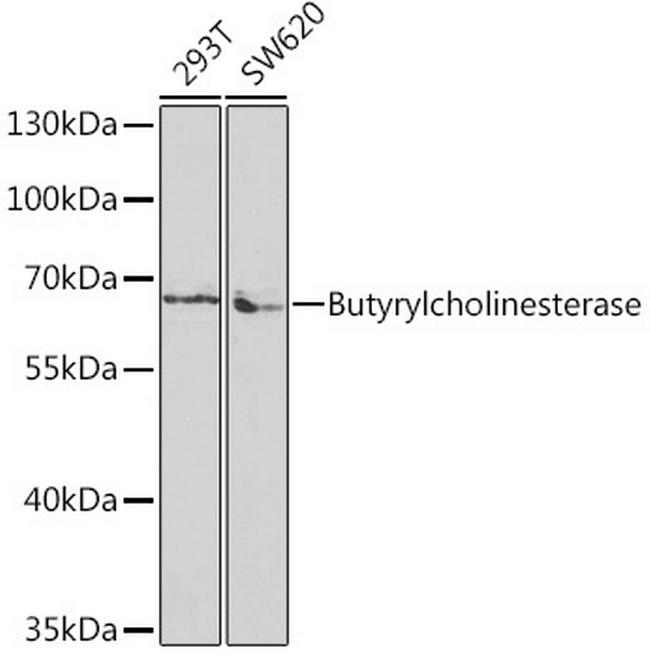 Butyrylcholinesterase Antibody in Western Blot (WB)