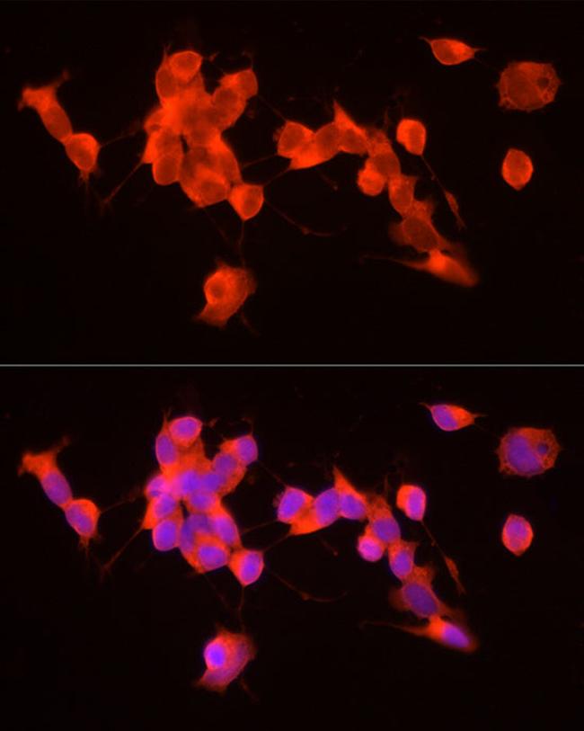 GDNF Antibody in Immunocytochemistry (ICC/IF)