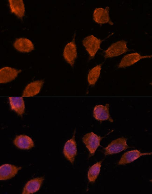 Importin 8 Antibody in Immunocytochemistry (ICC/IF)