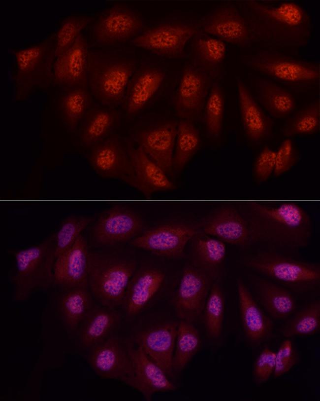 WTAP Antibody in Immunocytochemistry (ICC/IF)