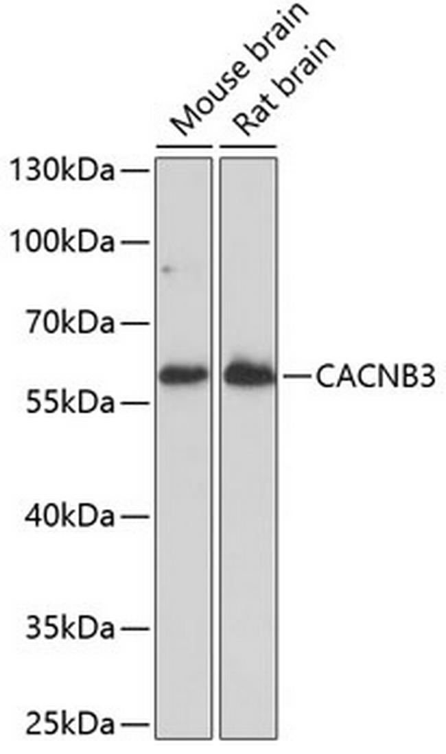 CACNB3 Antibody in Western Blot (WB)