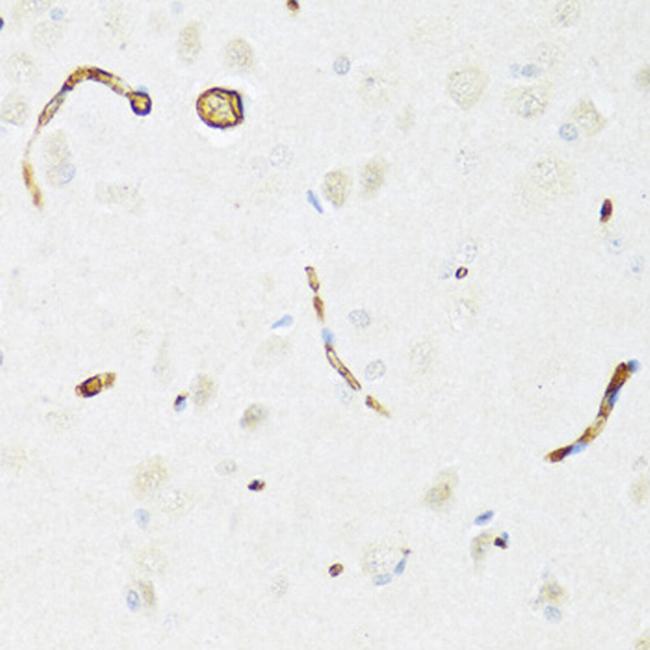 P-Glycoprotein Antibody in Immunohistochemistry (Paraffin) (IHC (P))