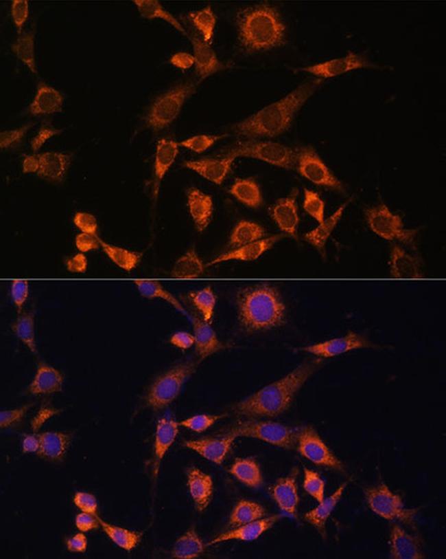 MEK2 Antibody in Immunocytochemistry (ICC/IF)