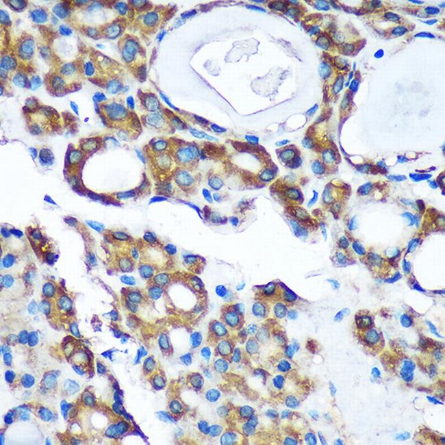 PDXDC1 Antibody in Immunohistochemistry (Paraffin) (IHC (P))