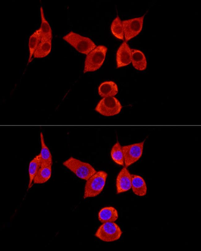 PABP Antibody in Immunocytochemistry (ICC/IF)