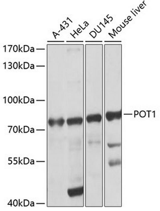 POT1 Antibody in Western Blot (WB)