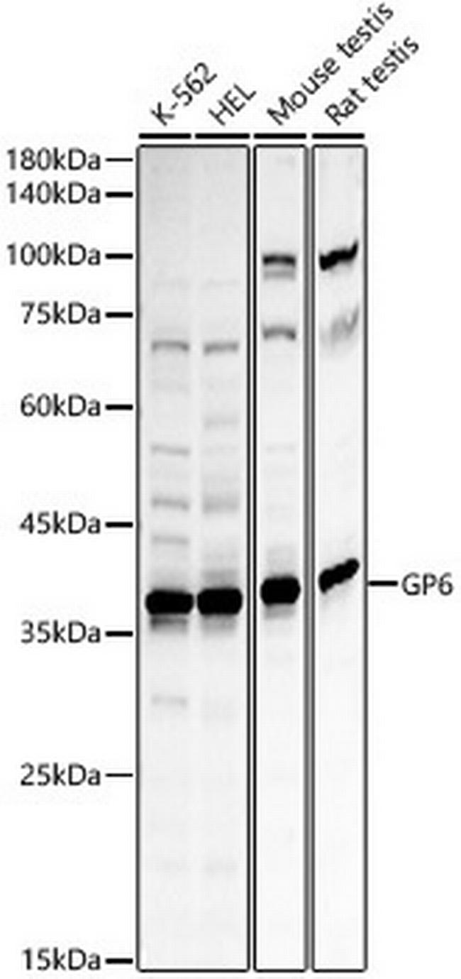 GP6 Antibody in Western Blot (WB)