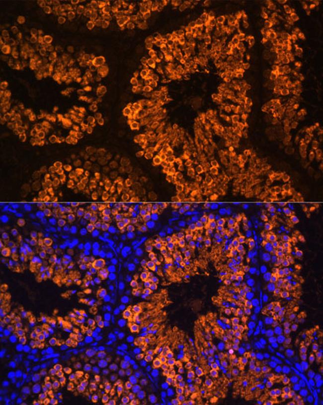 LDHC Antibody in Immunohistochemistry (Paraffin) (IHC (P))