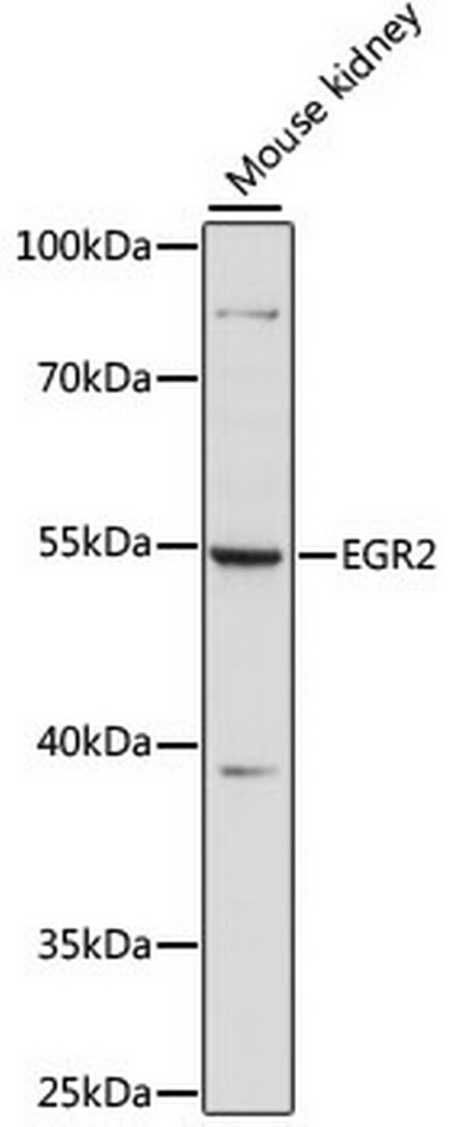 EGR2 Antibody in Western Blot (WB)