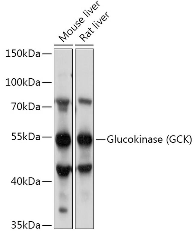 GCK Antibody in Western Blot (WB)