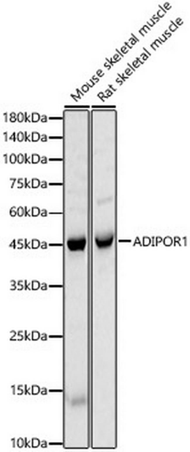 Adiponectin Receptor 1 Antibody in Western Blot (WB)