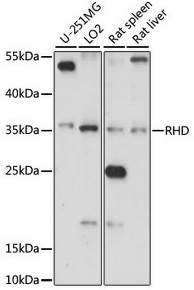 RHD Antibody in Western Blot (WB)