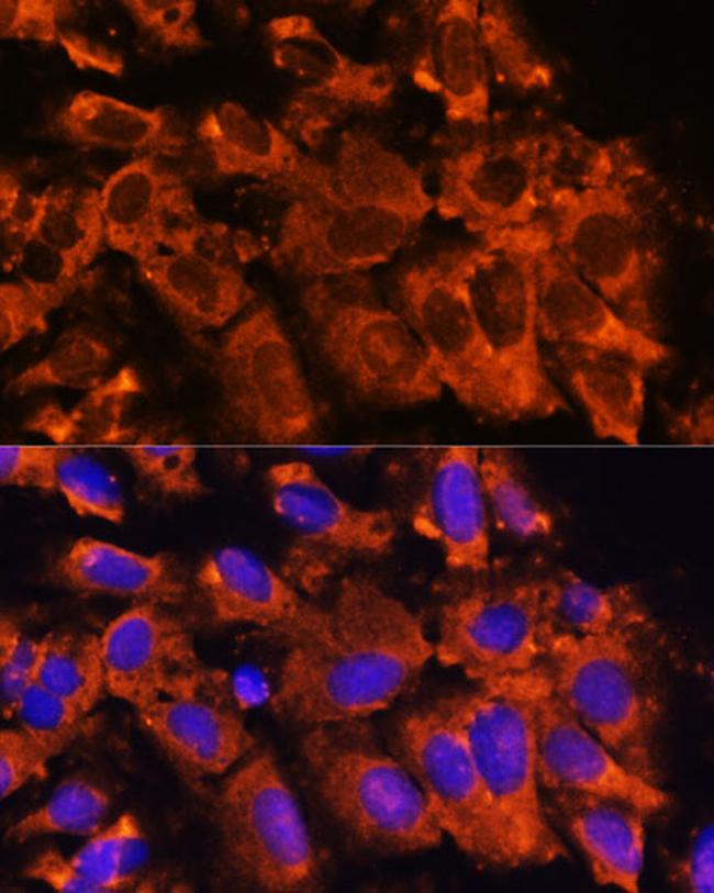 XK Antibody in Immunocytochemistry (ICC/IF)