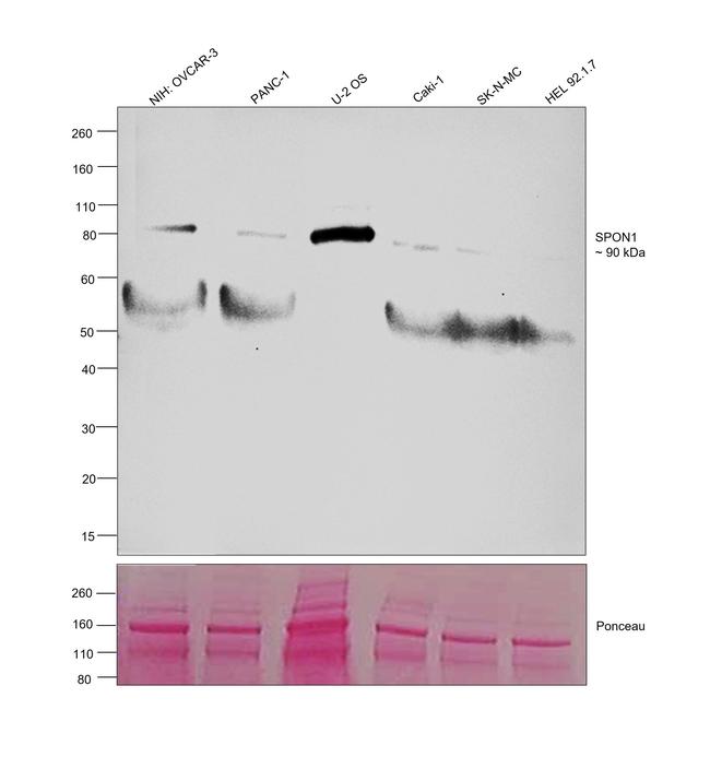 SPON1 Antibody in Western Blot (WB)