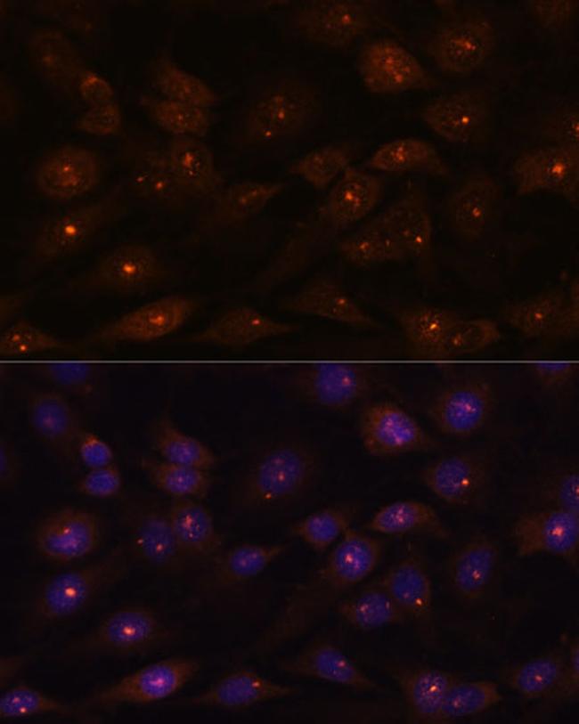 RNAse H2A Antibody in Immunocytochemistry (ICC/IF)