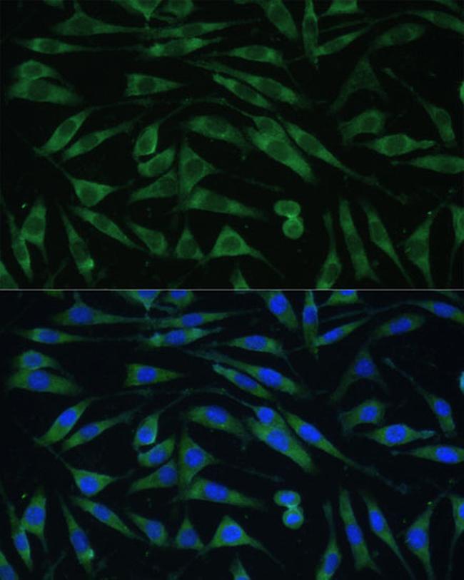 Dynamin 3 Antibody in Immunocytochemistry (ICC/IF)