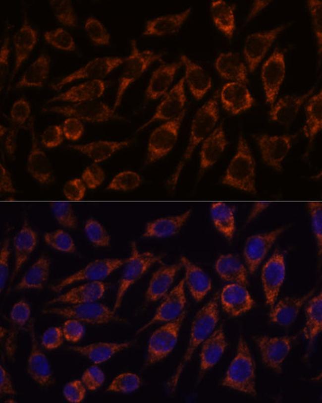 PYCR2 Antibody in Immunocytochemistry (ICC/IF)