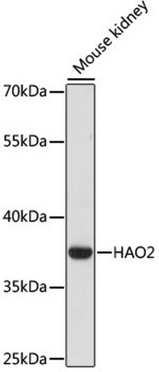 HAO2 Antibody in Western Blot (WB)