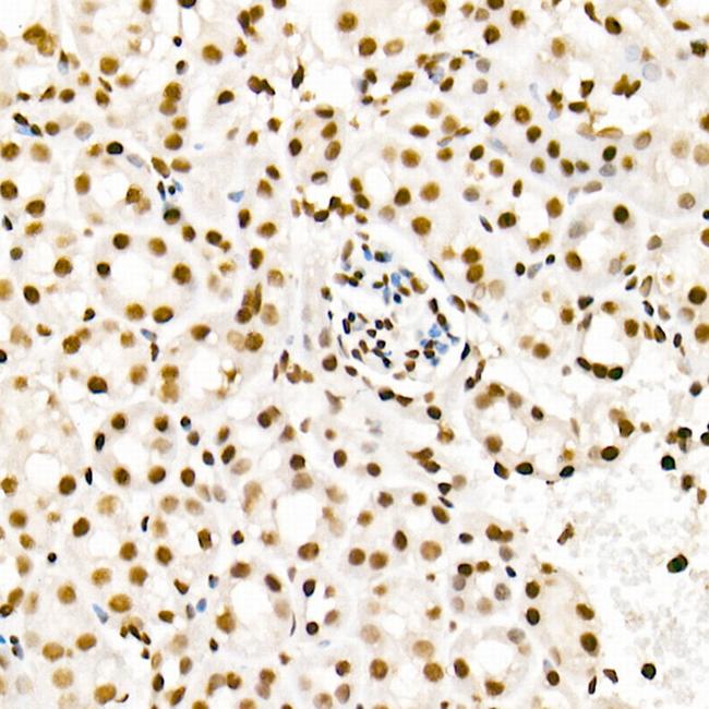 H4K5ac Antibody in Immunohistochemistry (Paraffin) (IHC (P))