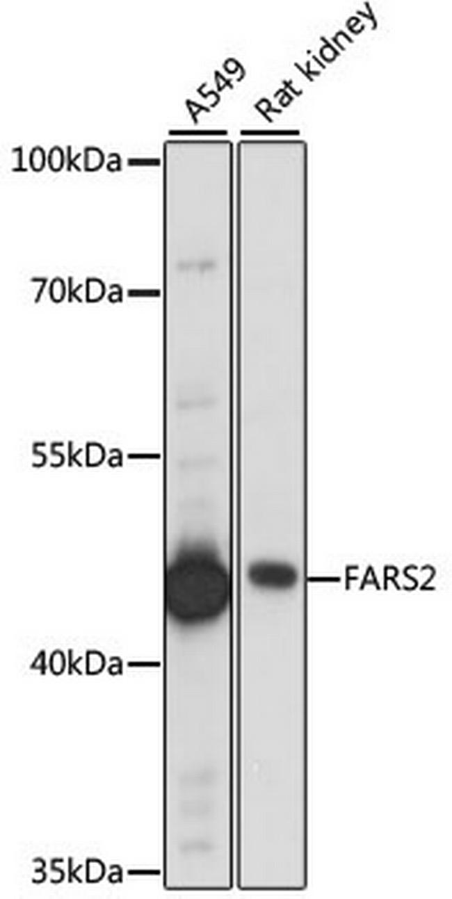 FARS2 Antibody in Western Blot (WB)