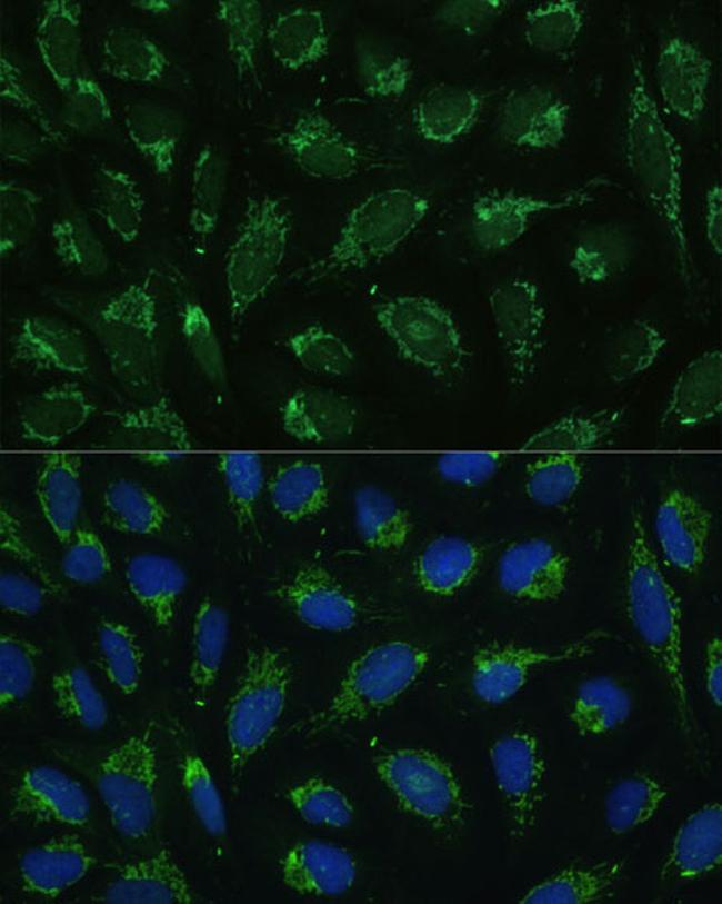 ATP Synthase gamma Antibody in Immunocytochemistry (ICC/IF)