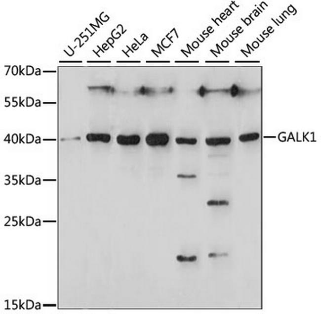 GALK1 Antibody in Western Blot (WB)