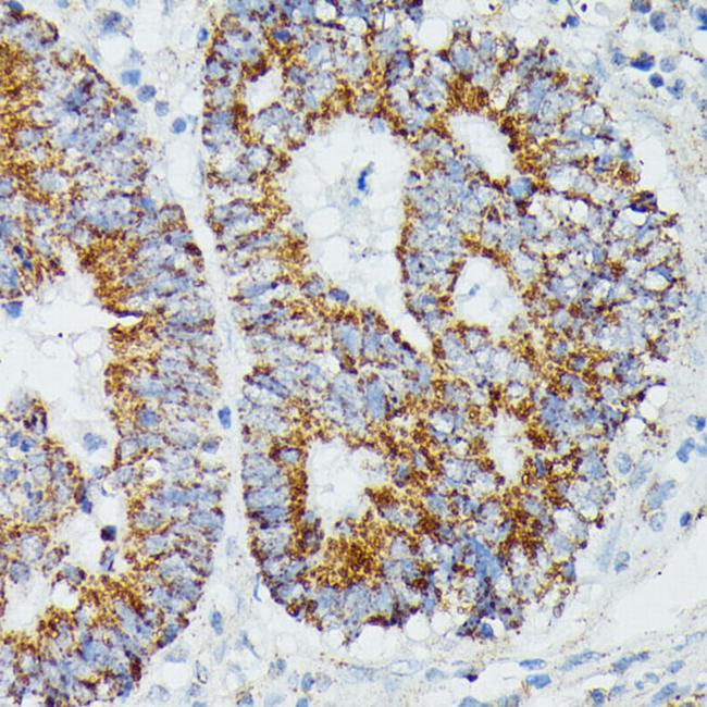 IVD Antibody in Immunohistochemistry (Paraffin) (IHC (P))