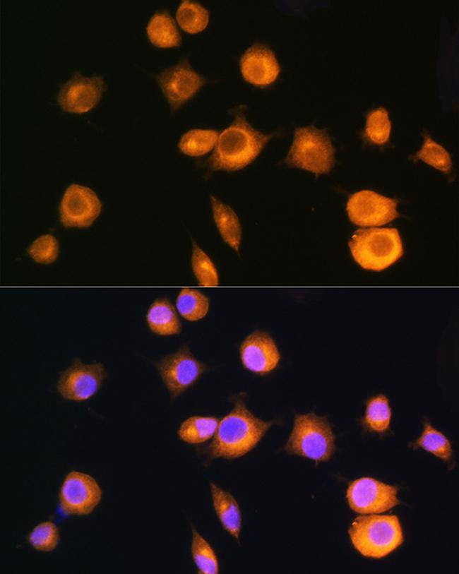 PRKAR2A Antibody in Immunocytochemistry (ICC/IF)