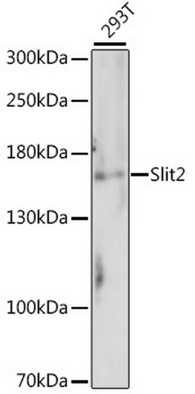 SLIT2 Antibody in Western Blot (WB)