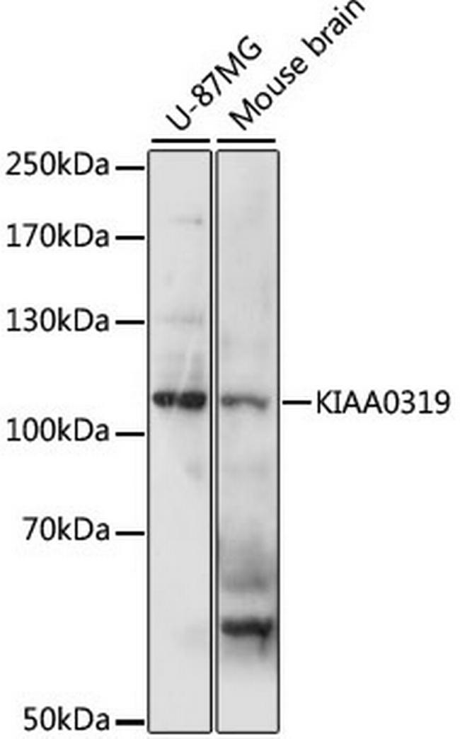 KIAA0319 Antibody in Western Blot (WB)