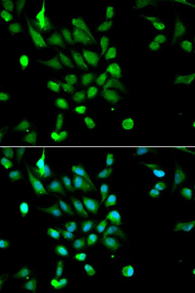 PSMC5 Antibody in Immunocytochemistry (ICC/IF)