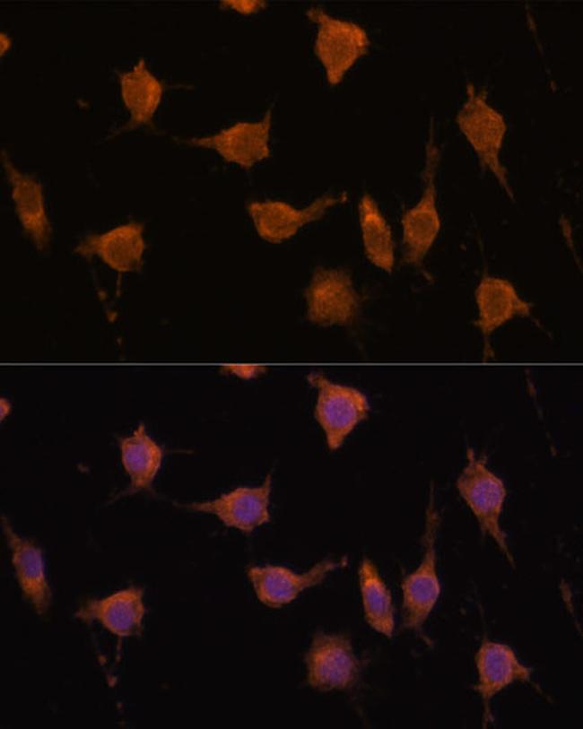 VAV3 Antibody in Immunocytochemistry (ICC/IF)