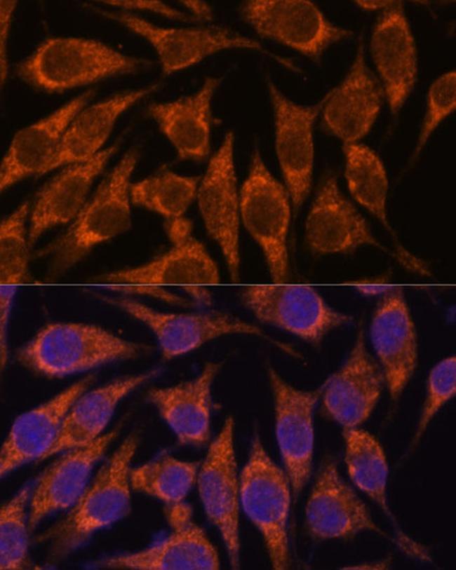 SEMA3C Antibody in Immunocytochemistry (ICC/IF)