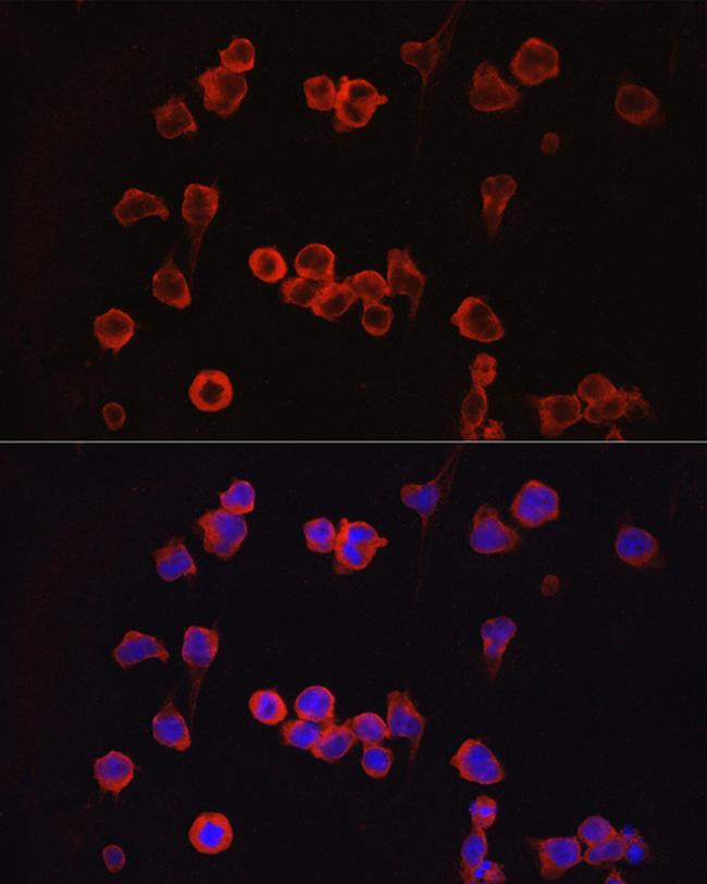 NFATC1 Antibody in Immunocytochemistry (ICC/IF)