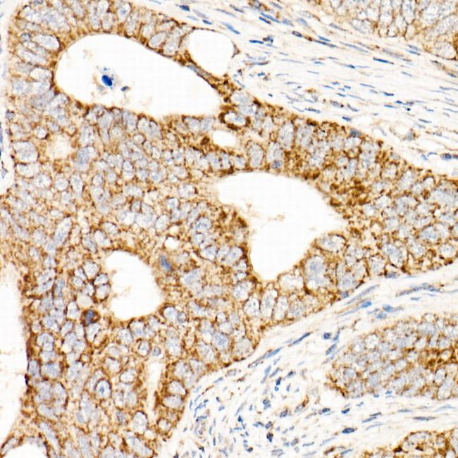 AFG3L2 Antibody in Immunohistochemistry (Paraffin) (IHC (P))