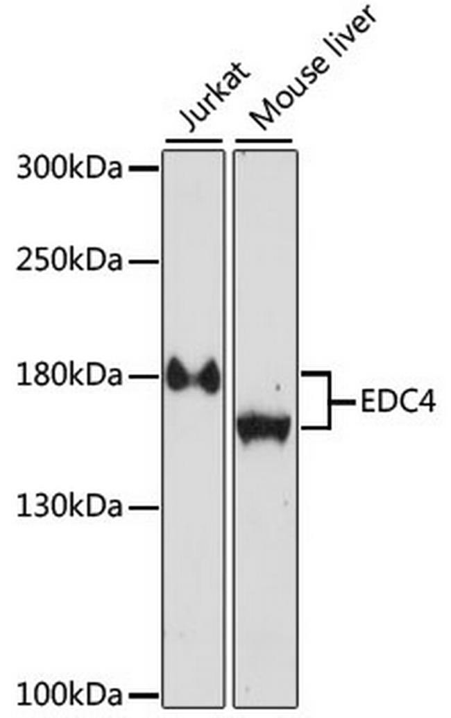 EDC4 Antibody in Western Blot (WB)