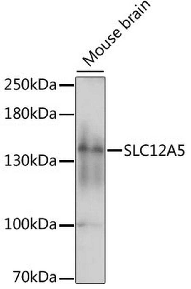 KCC2 Antibody in Western Blot (WB)