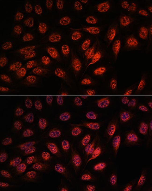 RBM25 Antibody in Immunocytochemistry (ICC/IF)