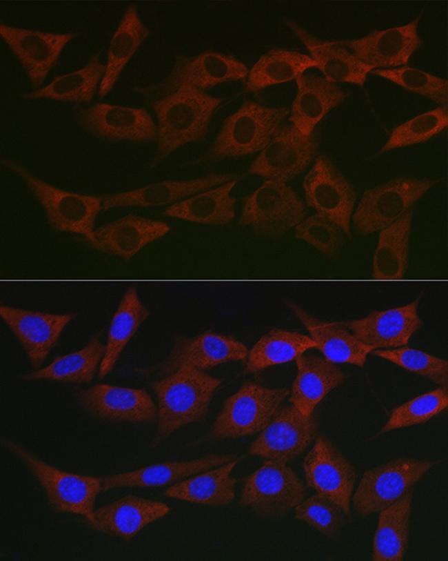 WNK3 Antibody in Immunocytochemistry (ICC/IF)