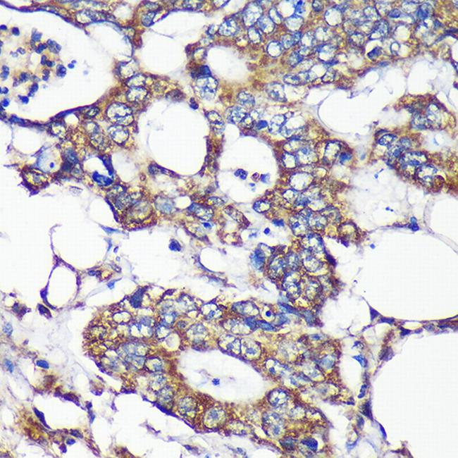 SLIRP Antibody in Immunohistochemistry (Paraffin) (IHC (P))