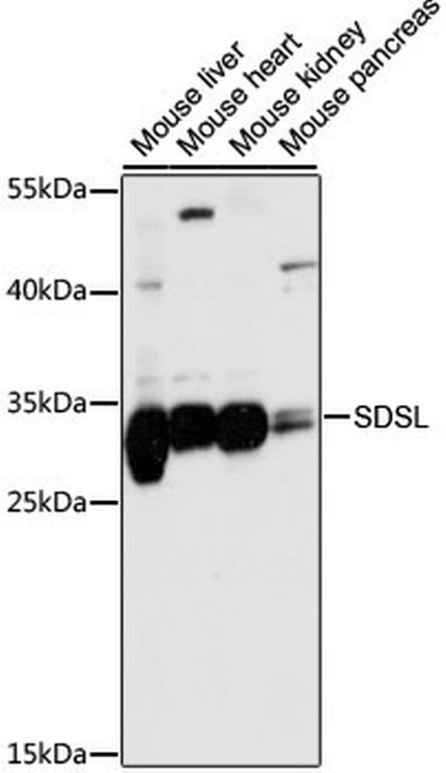 SDSL Antibody in Western Blot (WB)