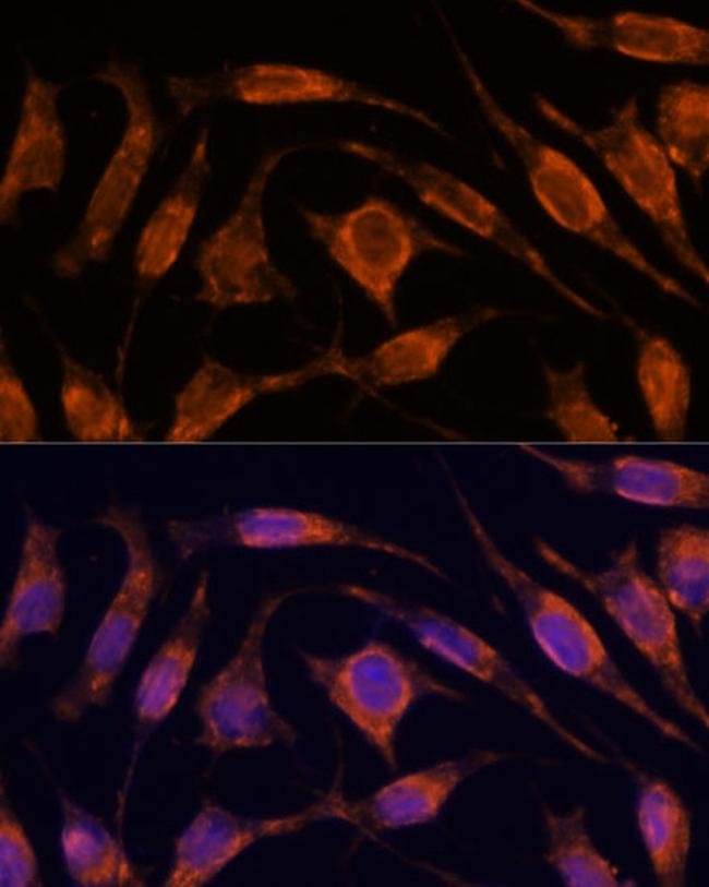 Importin 4 Antibody in Immunocytochemistry (ICC/IF)