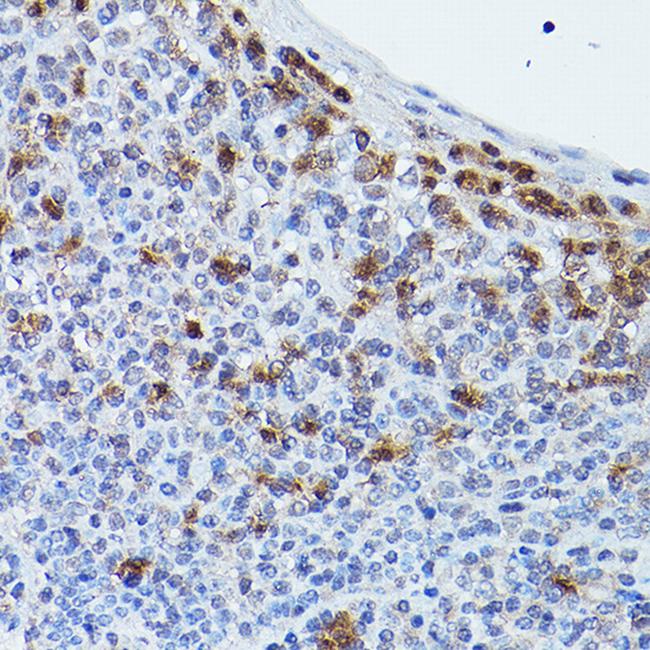 GPR109 Antibody in Immunohistochemistry (Paraffin) (IHC (P))