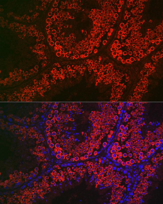 DDX4 Antibody in Immunocytochemistry (ICC/IF)