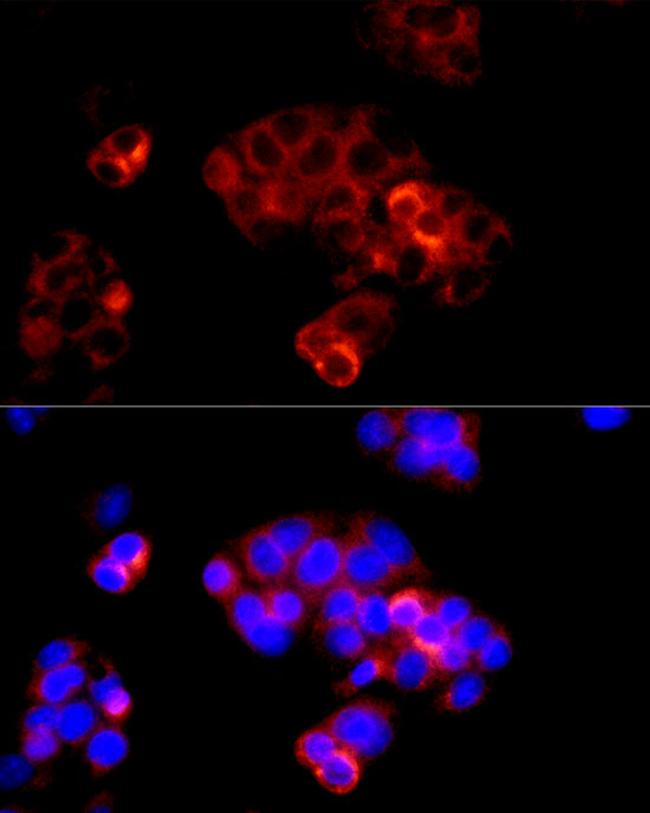 Angiotensinogen Antibody in Immunocytochemistry (ICC/IF)