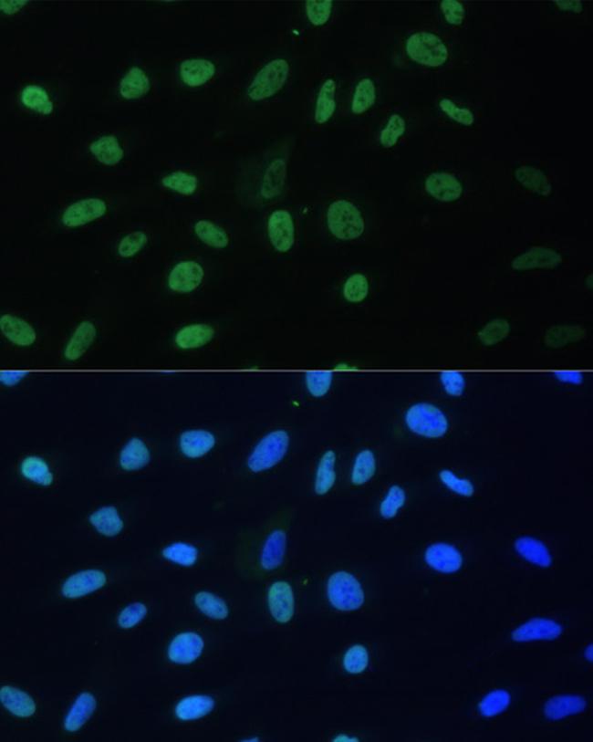 hnRNP D Antibody in Immunocytochemistry (ICC/IF)